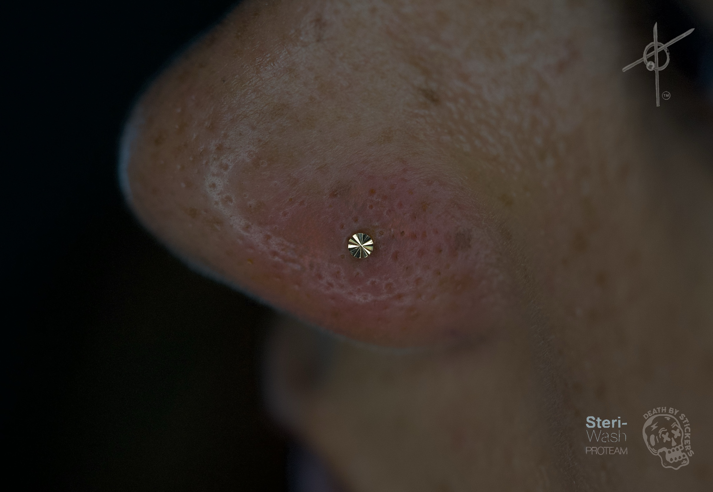 Close-up of a nose with visible pores and skin texture, slightly pinkish, against a dark background.