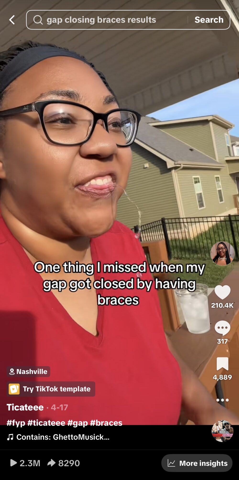 Woman with glasses smiling outdoors, houses in background, wearing red shirt, caption about braces and gaps.