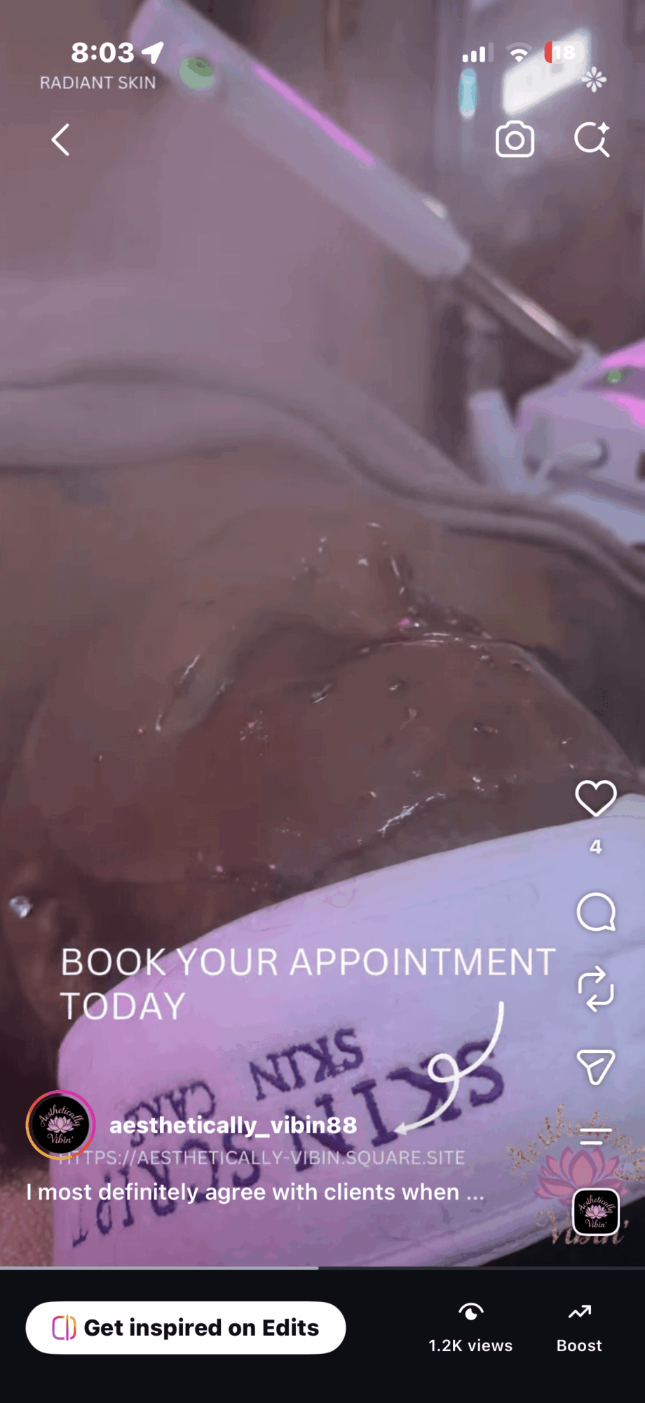 Close-up of a person's face with medical equipment and a tube, lying on a hospital bed.
